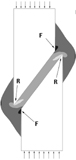 Hydrostatic stress plot from a finite element analysis of compressive forces acting on an oblique fracture site. 