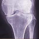 x-ray photo
