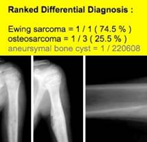 Bone Bayes