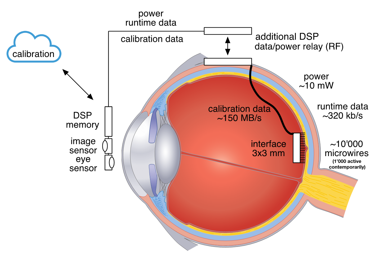 neuroscience-drive prosthesis design